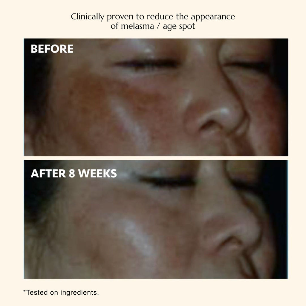 The Celebes Serum