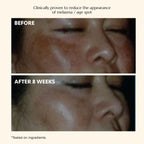 The Celebes Serum