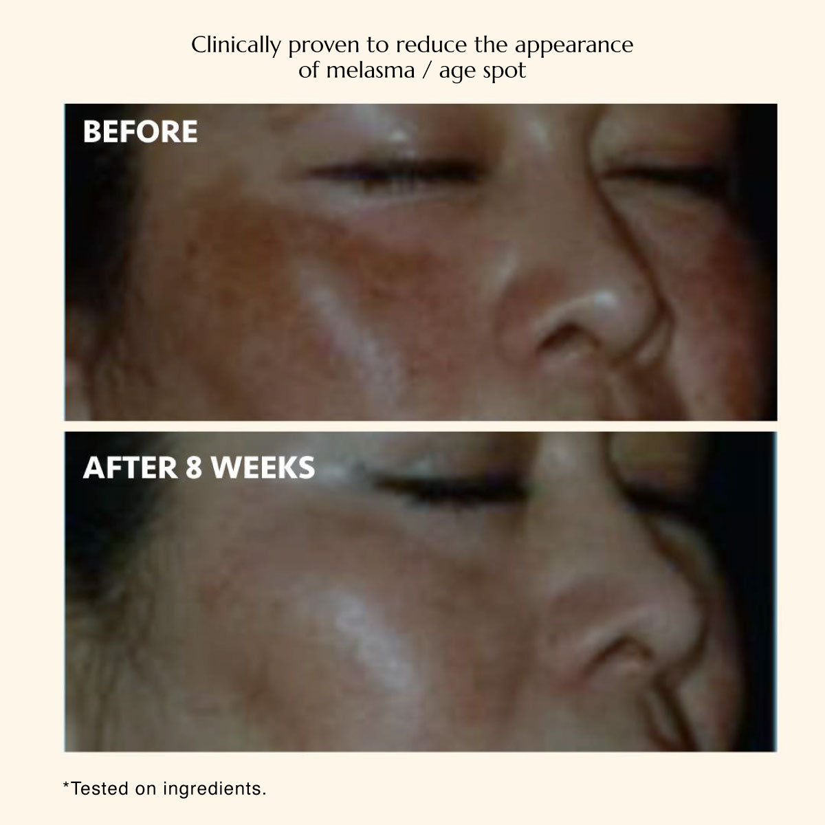 The Celebes Serum