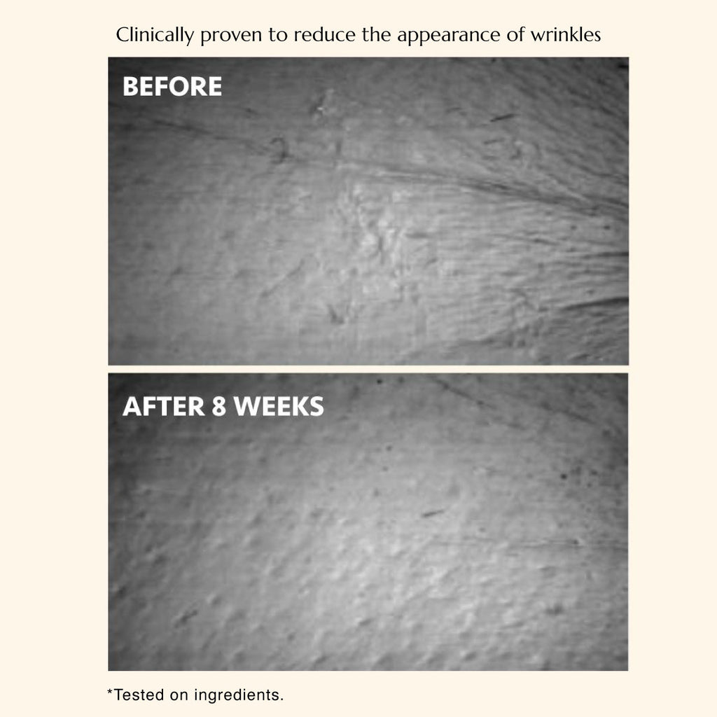 The Celebes Serum