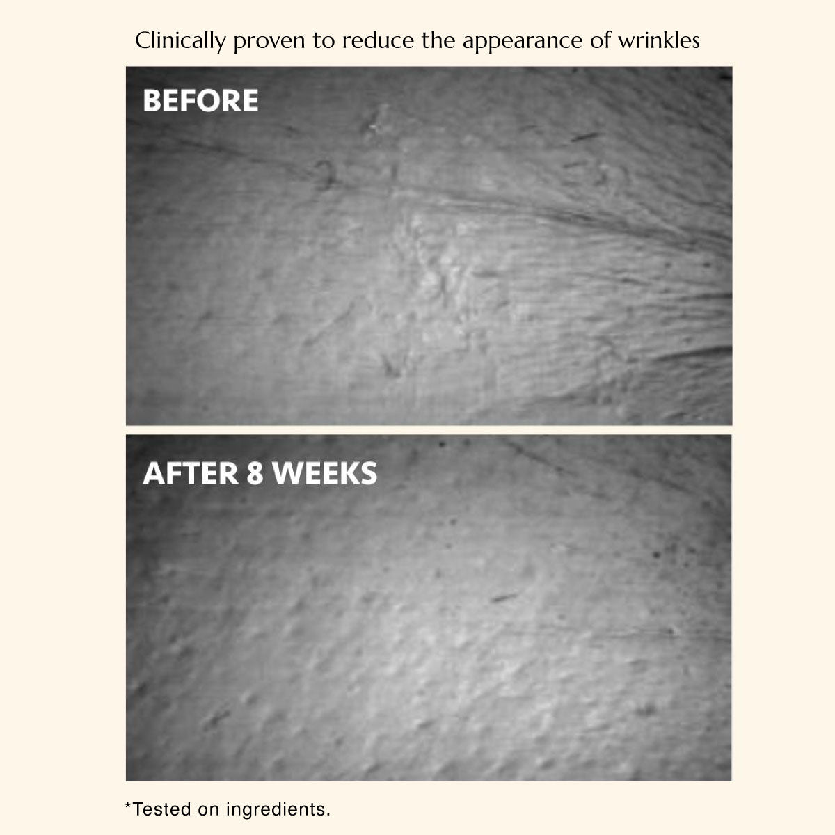 The Celebes Serum